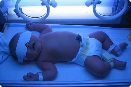 اختراع دستگاه تشخیص زردی نوزاد توسط بانوی مشهدی
